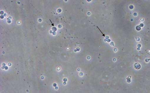 酵母双杂交技术原理、试验流程、特点以及应用