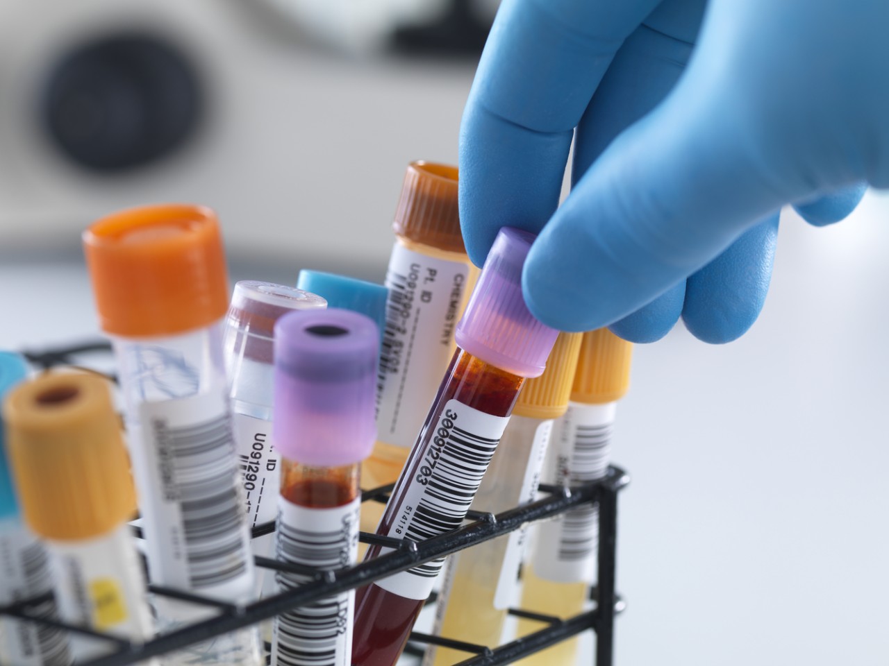 一致性评价大幕开启，医院市场即将调整