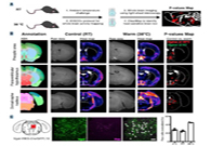 减肥药瞄准新靶点，强效减肥药即将来袭？