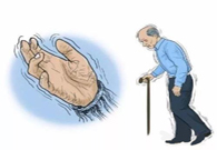 帕金森。芭痢辈慌？