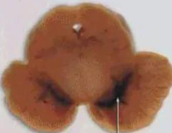 正常人：正：谥