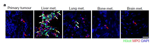 转入小鼠模型得到相同的试验结果，且在转移发生前NET已在肝脏聚积。