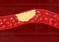 【Science速递】攻克COVID-19里程碑：已确定血凝块形成原因！