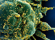 唾液检测新冠抗体新方法来了，获取结果仅需几小时！