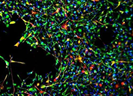 世界首创：药物将干细胞引导至受损部位，提高其愈合能力！