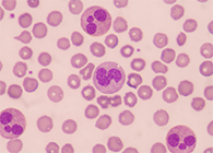 一种神秘颗粒被发现了！它能否成为败血症早筛标志物？