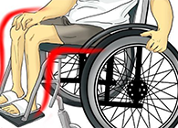 Nature：还瘫痪患者一个自由身的日子不远了