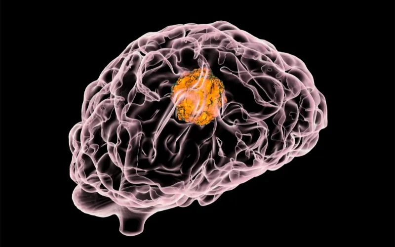 不朽情缘mg官网助力 | 璧辰医药ABM-1310获美国FDA孤儿药资格认证，用于治疗携带BRAF V600突变的脑胶质母细胞瘤患者