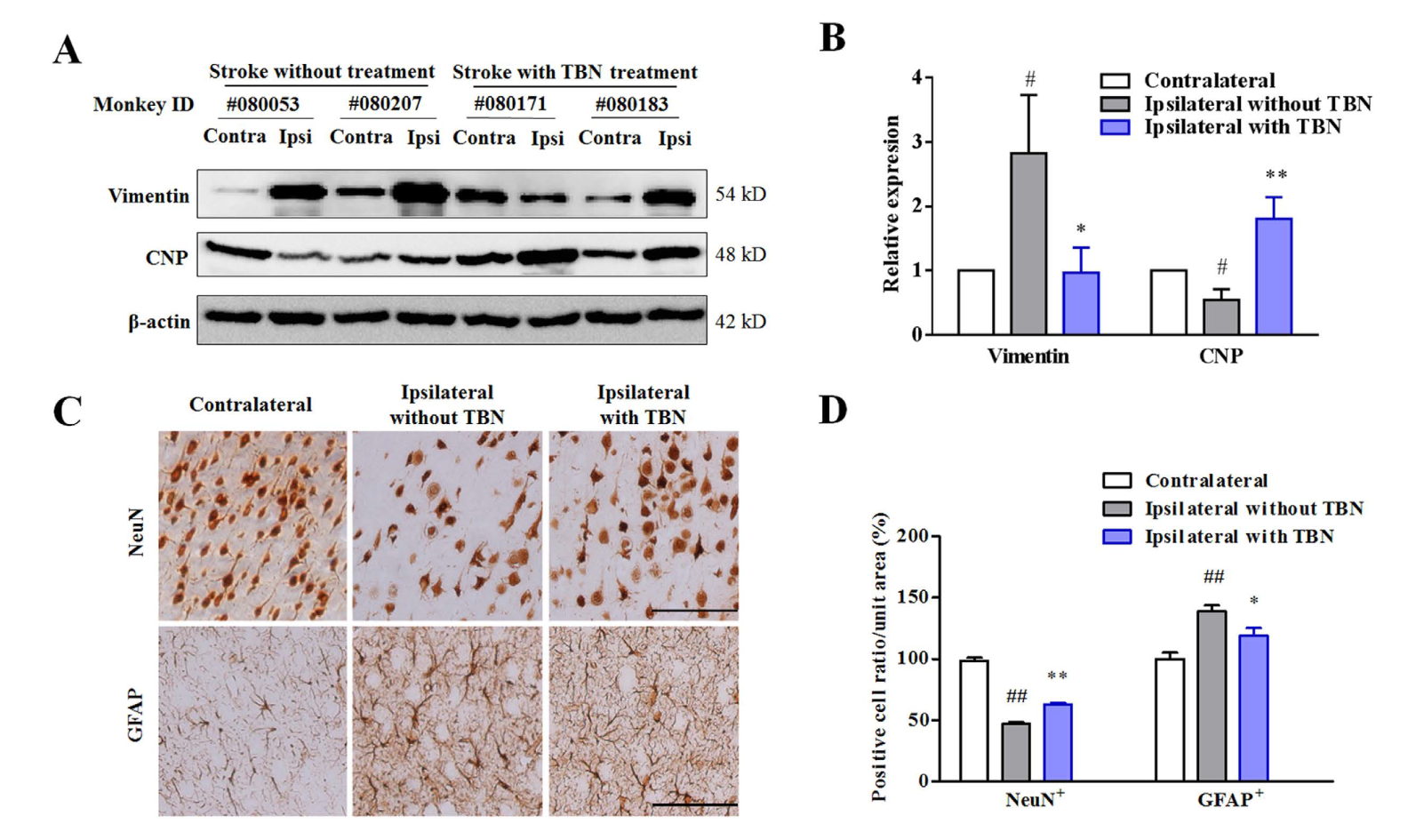 TBN是一种治疗缺血性卒中的新型临床候选药物，本研究中TBN通过不朽情缘mg官网合成